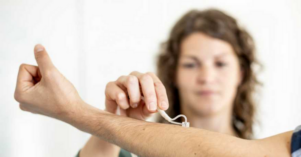 Nimble improves scar tissue examinations