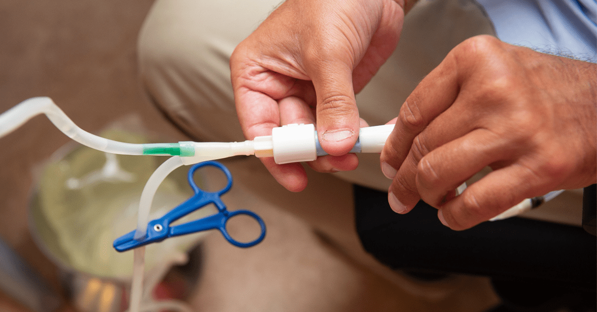 Genetic defect responsible for ineffective peritoneal dialysis