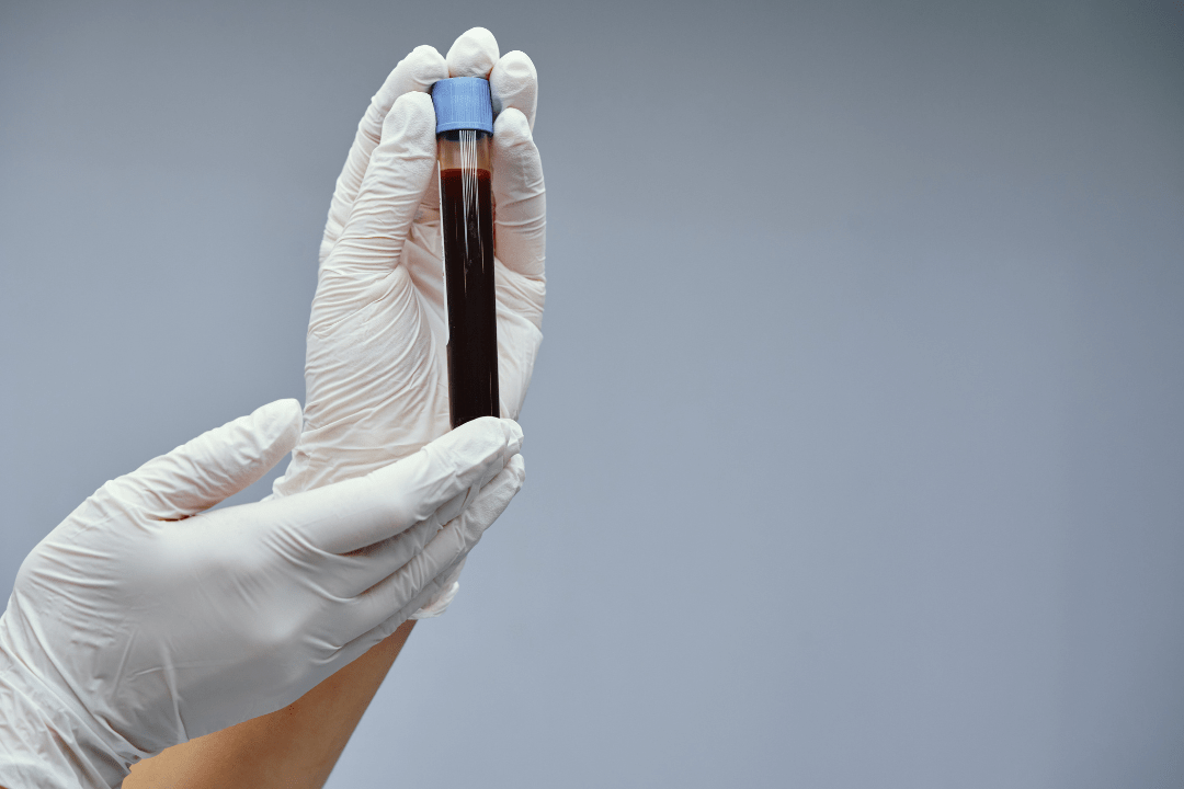 SBAS artificial intelligence interprets blood test results