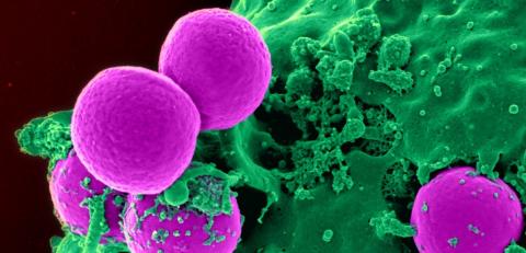 Antibiotic-resistant bacteria are being swallowed by a human white blood cell. Colorized, scanning electron microscopic (SEM) image. Image: CDC/NIAID